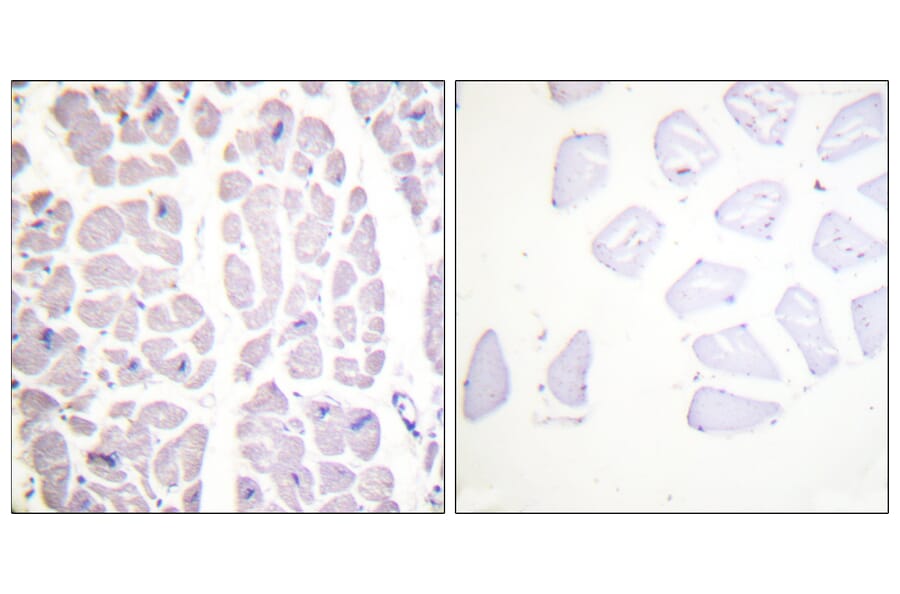 Immunohistochemistry - Anti-IKK alpha + beta (phospho Ser180 + Ser181) Antibody (A0440) - Antibodies.com