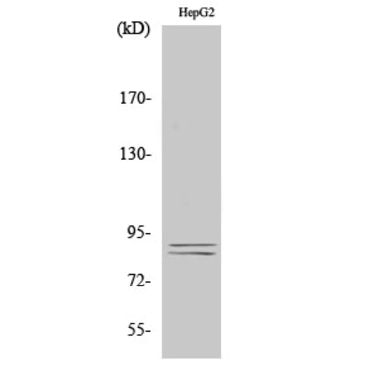 Western Blot - Anti-IKK alpha + beta (phospho Ser180 + Ser181) Antibody (A0440) - Antibodies.com