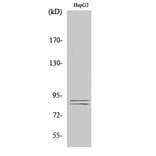 Western Blot - Anti-IKK alpha + beta (phospho Ser180 + Ser181) Antibody (A0440) - Antibodies.com