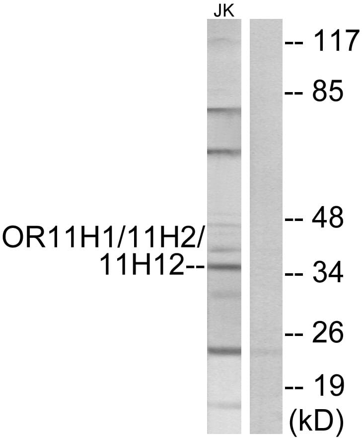 Western blot analysis of lysates from Jurkat cells using Anti-OR11H1 + OR11H2 + OR11H12 Antibody. The right hand lane represents a negative control, where the antibody is blocked by the immunising peptide.