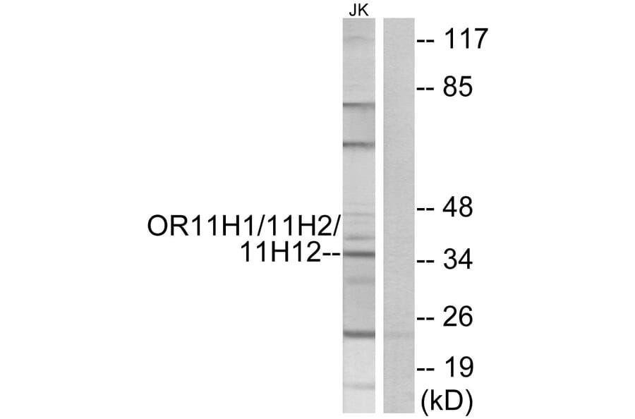 Western Blot - Anti-OR11H1 + OR11H2 + OR11H12 Antibody (G835) - Antibodies.com