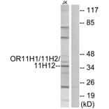Western Blot - Anti-OR11H1 + OR11H2 + OR11H12 Antibody (G835) - Antibodies.com