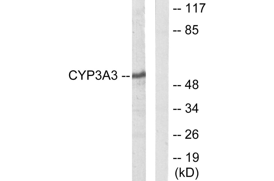 Western Blot - Anti-Cytochrome P450 3A4 + 3A5 Antibody (C12276) - Antibodies.com