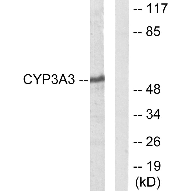 Western Blot - Anti-Cytochrome P450 3A4 + 3A5 Antibody (C12276) - Antibodies.com