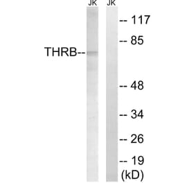 Western Blot - Anti-THRB (AP2,cleaved Arg327) Antibody (L0383) - Antibodies.com