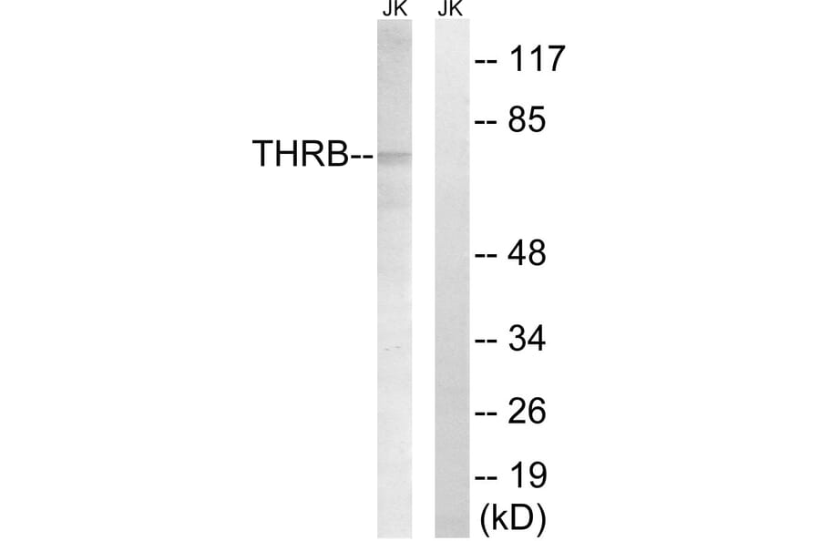 Western Blot - Anti-THRB (AP2,cleaved Arg327) Antibody (L0383) - Antibodies.com