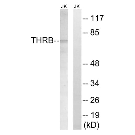 Western Blot - Anti-THRB (AP2,cleaved Arg327) Antibody (L0383) - Antibodies.com