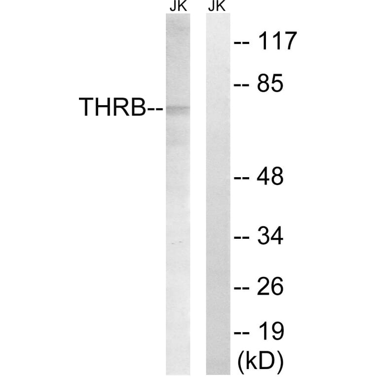 Western Blot - Anti-THRB (AP2,cleaved Arg327) Antibody (L0383) - Antibodies.com