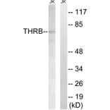 Western Blot - Anti-THRB (AP2,cleaved Arg327) Antibody (L0383) - Antibodies.com