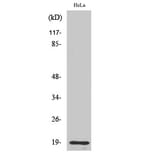 Western Blot - Anti-THRB (AP2,cleaved Arg327) Antibody (L0383) - Antibodies.com