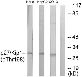 Western Blot - Anti-p27 Kip1 (phospho Thr198) Antibody (A0965) - Antibodies.com
