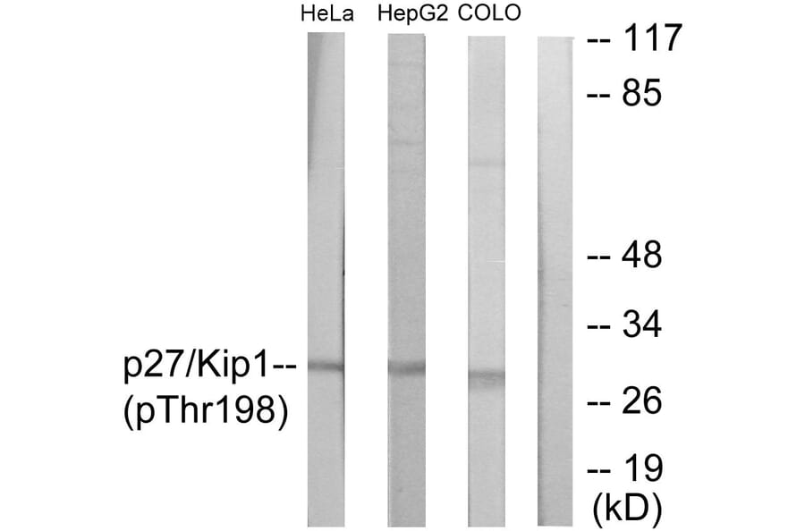 Western Blot - Anti-p27 Kip1 (phospho Thr198) Antibody (A0965) - Antibodies.com