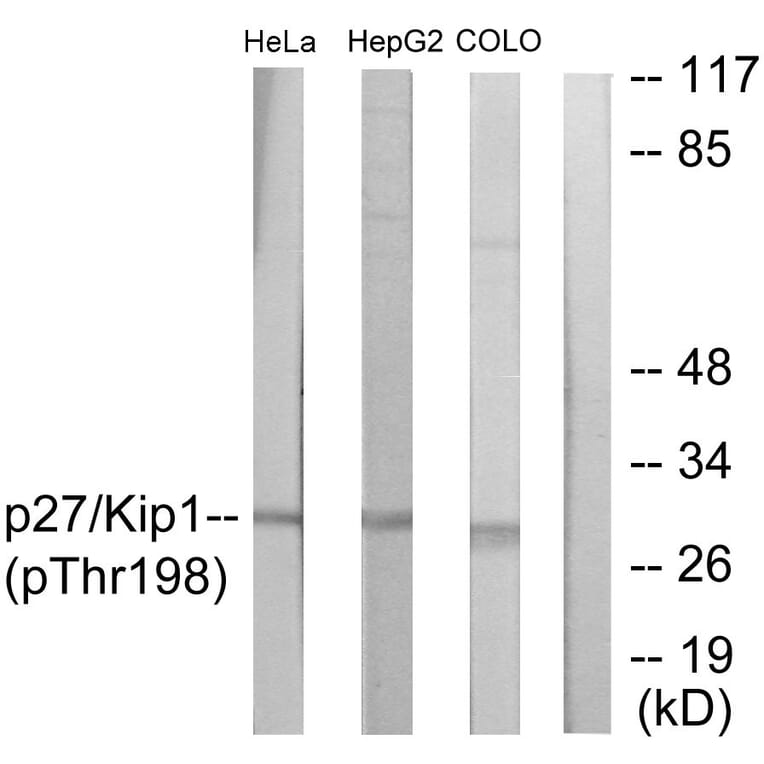 Western Blot - Anti-p27 Kip1 (phospho Thr198) Antibody (A0965) - Antibodies.com