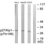 Western Blot - Anti-p27 Kip1 (phospho Thr198) Antibody (A0965) - Antibodies.com