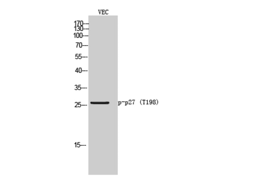 Western Blot - Anti-p27 Kip1 (phospho Thr198) Antibody (A0965) - Antibodies.com