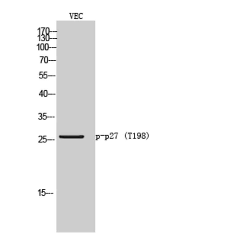 Western Blot - Anti-p27 Kip1 (phospho Thr198) Antibody (A0965) - Antibodies.com