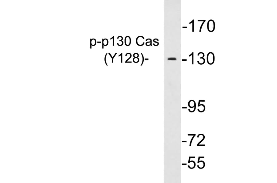 Western Blot - Anti-p130 Cas (phospho Tyr128) Antibody (P12-1038) - Antibodies.com
