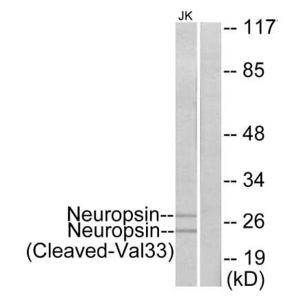 Western Blot - Anti-Neuropsin (cleaved Val33) Antibody (L0345) - Antibodies.com