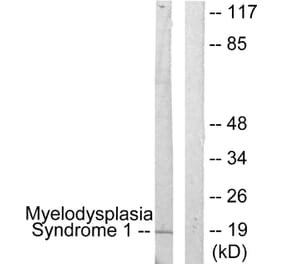 Western Blot - Anti-Myelodysplasia Syndrome 1 Antibody (C10980) - Antibodies.com