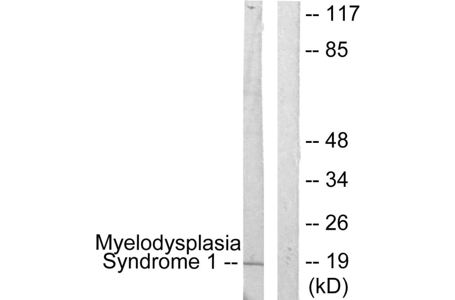 Western Blot - Anti-Myelodysplasia Syndrome 1 Antibody (C10980) - Antibodies.com