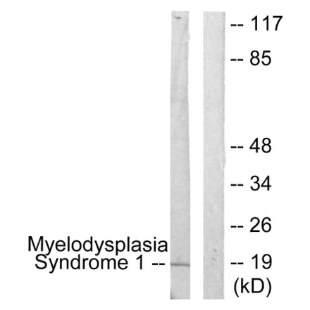 Western Blot - Anti-Myelodysplasia Syndrome 1 Antibody (C10980) - Antibodies.com