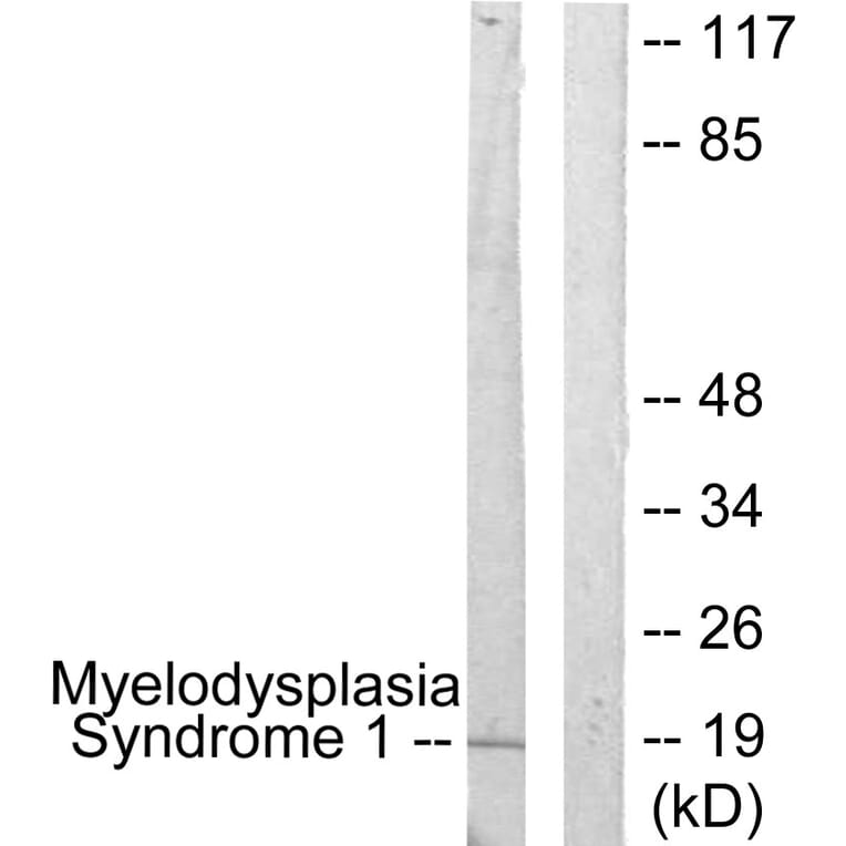 Western Blot - Anti-Myelodysplasia Syndrome 1 Antibody (C10980) - Antibodies.com