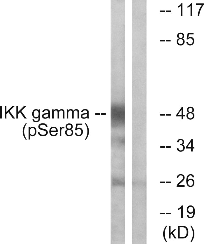 Anti-IKK-gamma (phospho Ser85) Antibody (A95270) | Antibodies.com