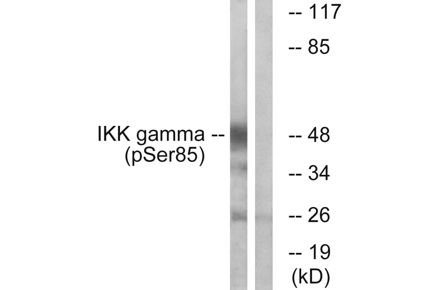 Western Blot - Anti-IKK-gamma (phospho Ser85) Antibody (A1151) - Antibodies.com