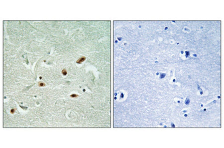 Immunohistochemistry - Anti-DNA-PK (phospho Ser2612) Antibody (A0907) - Antibodies.com