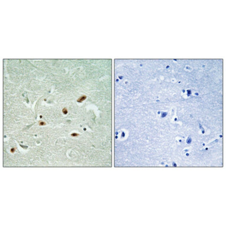 Immunohistochemistry - Anti-DNA-PK (phospho Ser2612) Antibody (A0907) - Antibodies.com