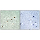 Immunohistochemistry - Anti-DNA-PK (phospho Ser2612) Antibody (A0907) - Antibodies.com