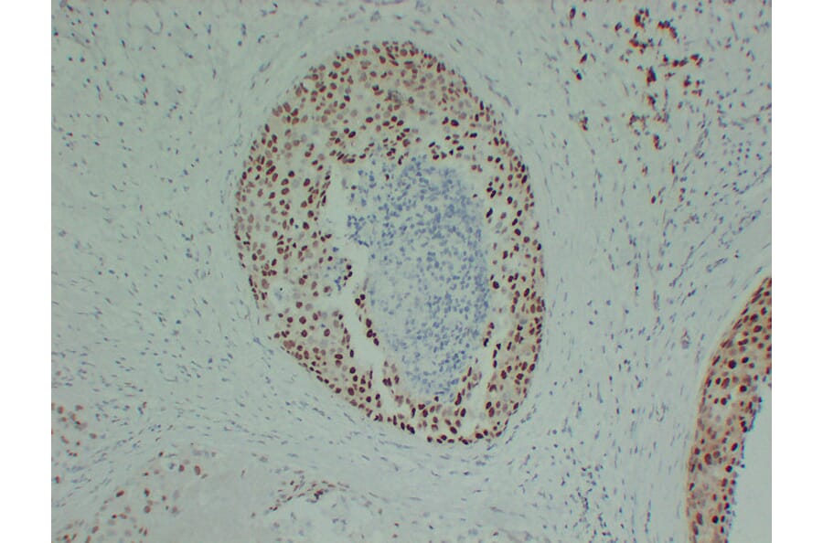 Immunohistochemistry - Anti-Estrogen Receptor alpha Antibody (V0069) - Antibodies.com