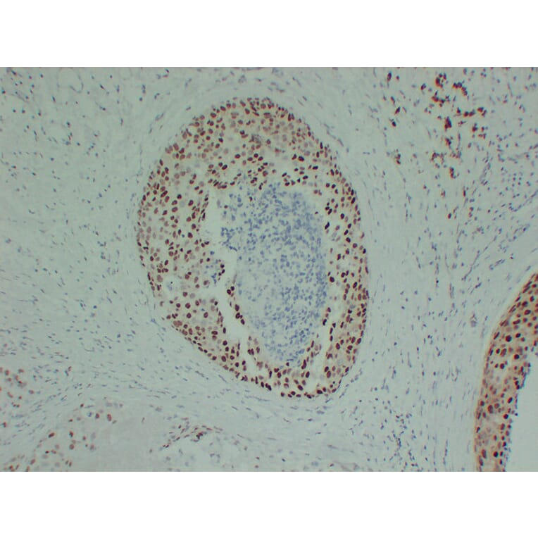 Immunohistochemistry - Anti-Estrogen Receptor alpha Antibody (V0069) - Antibodies.com