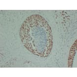 Immunohistochemistry - Anti-Estrogen Receptor alpha Antibody (V0069) - Antibodies.com