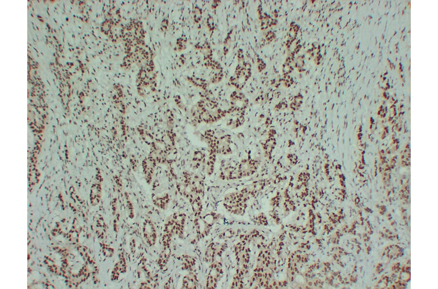 Immunohistochemistry - Anti-Estrogen Receptor alpha Antibody (V0069) - Antibodies.com