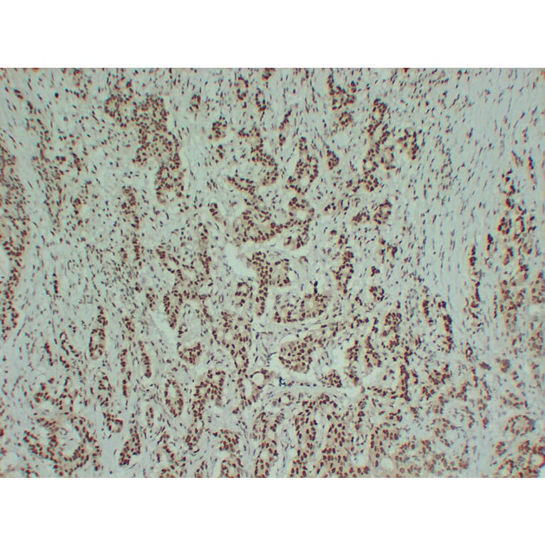 Immunohistochemistry - Anti-Estrogen Receptor alpha Antibody (V0069) - Antibodies.com