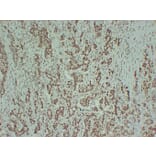 Immunohistochemistry - Anti-Estrogen Receptor alpha Antibody (V0069) - Antibodies.com