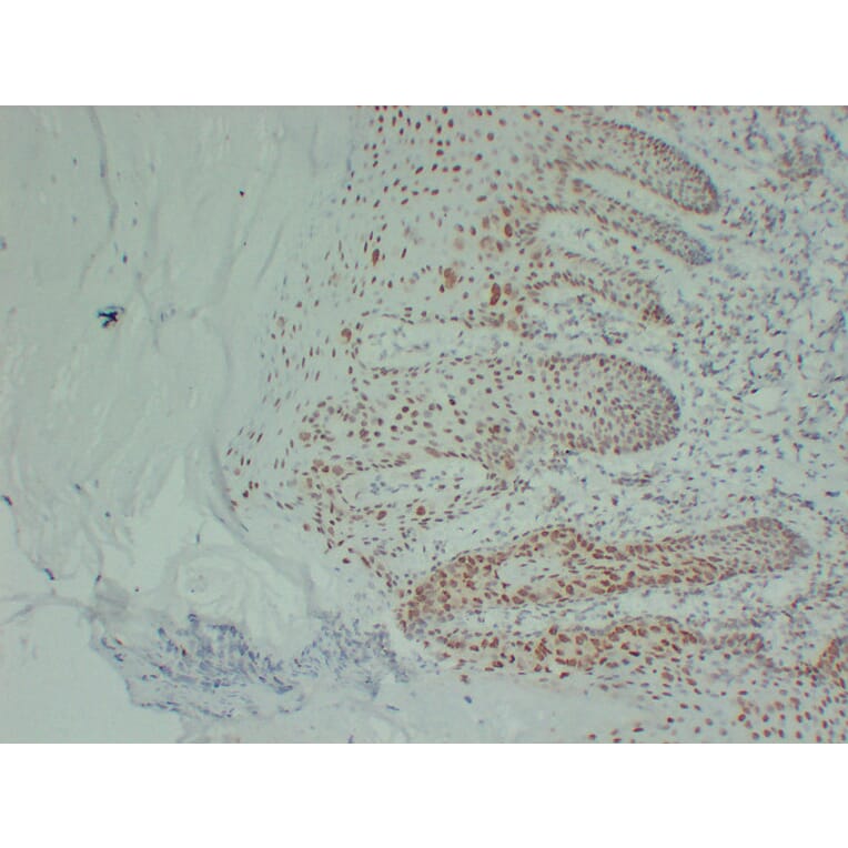 Immunohistochemistry - Anti-Estrogen Receptor alpha Antibody (V0069) - Antibodies.com