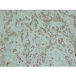 Immunohistochemistry - Anti-Estrogen Receptor alpha Antibody (V0069) - Antibodies.com