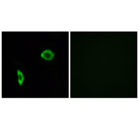 Immunofluorescence - Anti-Prostacyclin Receptor Antibody (G725) - Antibodies.com