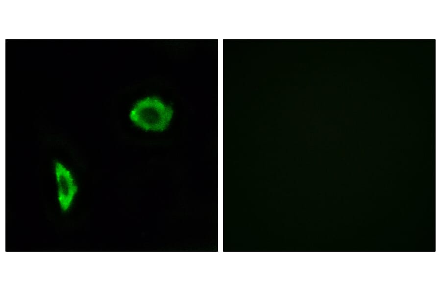 Immunofluorescence - Anti-Prostacyclin Receptor Antibody (G725) - Antibodies.com