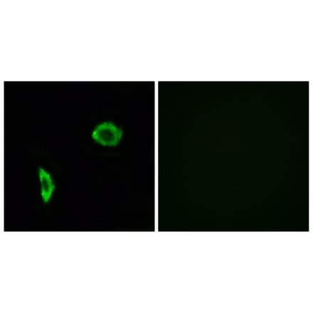 Immunofluorescence - Anti-Prostacyclin Receptor Antibody (G725) - Antibodies.com