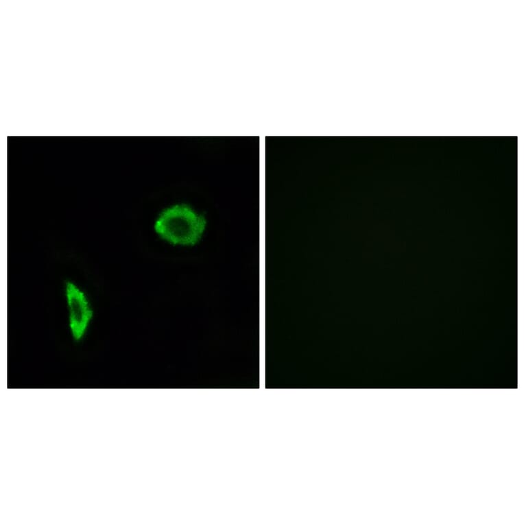 Immunofluorescence - Anti-Prostacyclin Receptor Antibody (G725) - Antibodies.com