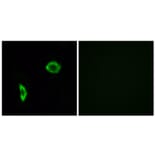 Immunofluorescence - Anti-Prostacyclin Receptor Antibody (G725) - Antibodies.com