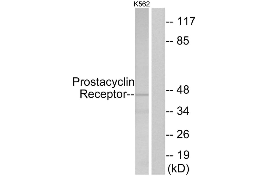 Western Blot - Anti-Prostacyclin Receptor Antibody (G725) - Antibodies.com
