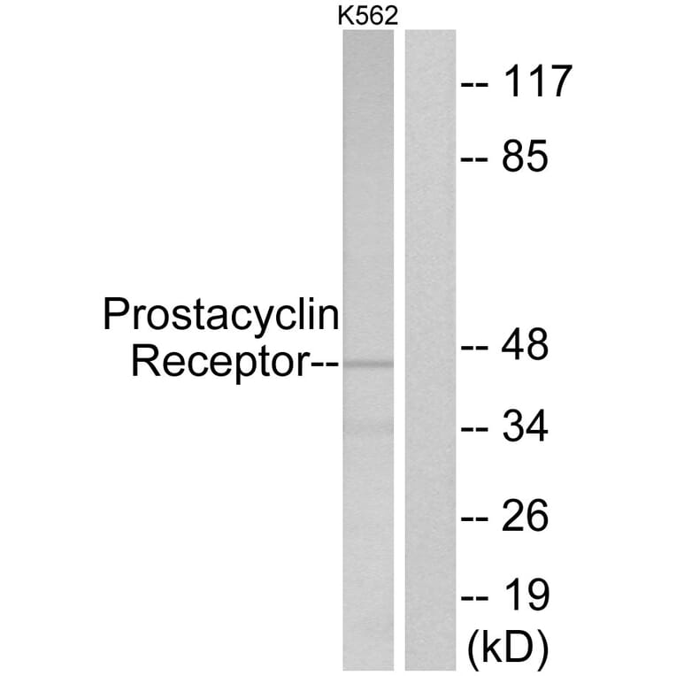 Western Blot - Anti-Prostacyclin Receptor Antibody (G725) - Antibodies.com