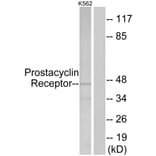 Western Blot - Anti-Prostacyclin Receptor Antibody (G725) - Antibodies.com