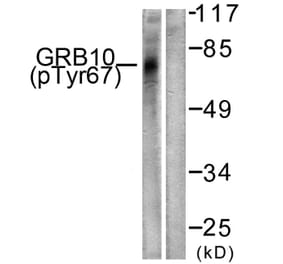 Western Blot - Anti-GRB10 (phospho Tyr67) Antibody (A1031) - Antibodies.com