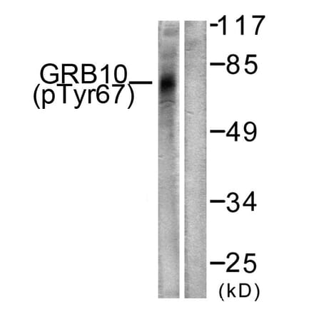 Western Blot - Anti-GRB10 (phospho Tyr67) Antibody (A1031) - Antibodies.com