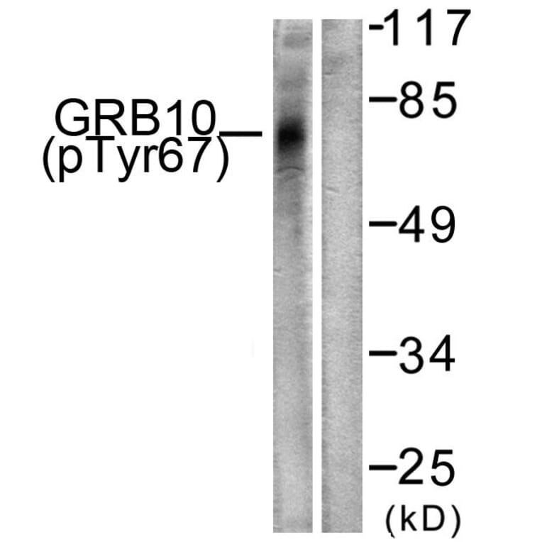 Western Blot - Anti-GRB10 (phospho Tyr67) Antibody (A1031) - Antibodies.com